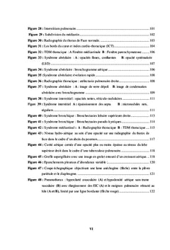 Semiologie medicale de l'appareil respiratoire tome 1