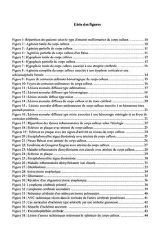 IRM et pathologie du corps calleux: revue iconographique