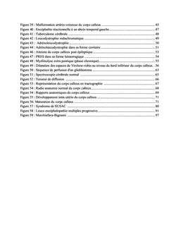 IRM et pathologie du corps calleux: revue iconographique