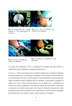 Chirurgie De La Douleur en Pratique