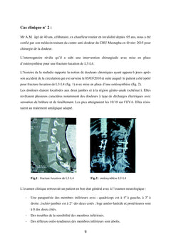 Chirurgie De La Douleur en Pratique