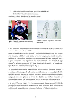Chirurgie De La Douleur en Pratique