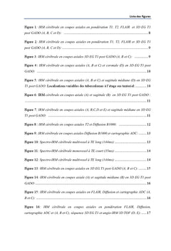 IRM des tuberculomes intracranien