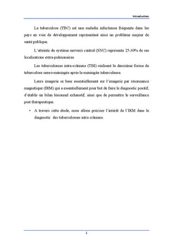 IRM des tuberculomes intracranien