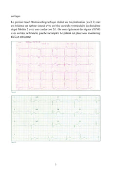 L'ECG en pratique clinique