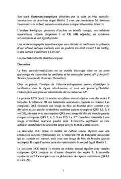 L'ECG en pratique clinique