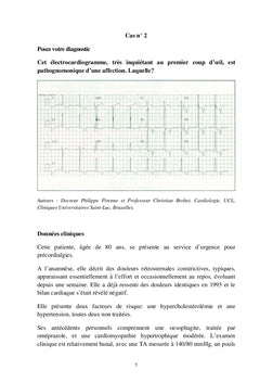 L'ECG en pratique clinique