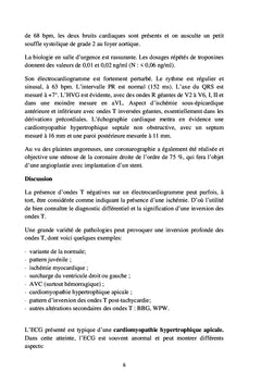 L'ECG en pratique clinique