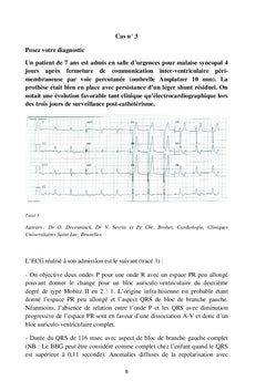 L'ECG en pratique clinique