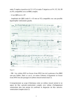 L'ECG en pratique clinique