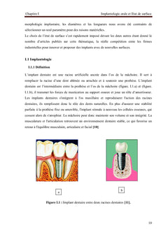 Comportement des Prothèses Dentaires