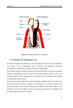 Comportement des Prothèses Dentaires