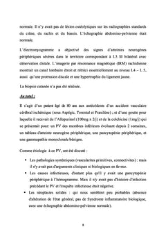 Particularités du purpura vasculaire induit par l'allopurinol