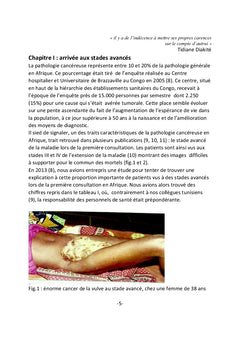 Esprit de cancérologue
