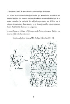 Les phéochromocytomes