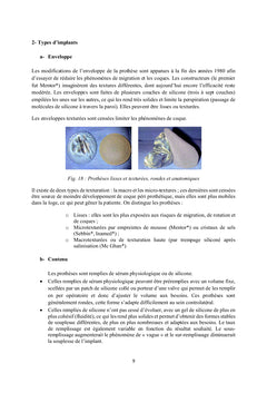 Cancer du Sein : Prothèses Mammaires