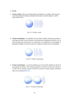 Cancer du Sein : Prothèses Mammaires