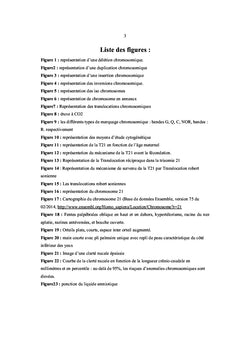 Trisomie 21: Expérience du Laboratoire de Cytogénétique CHU de Sétif