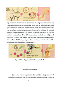 Pollinose chez les adolescents