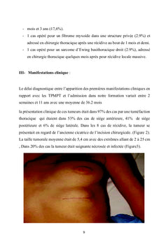 Les tumeurs primitives de la paroi thoracique :