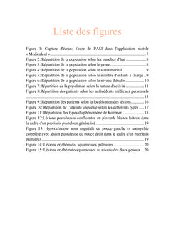 Impact du psoriasis sur l'activité professionnelle