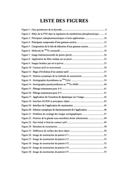 Interet de la scintigraphie parathyroïdienne de soustraction