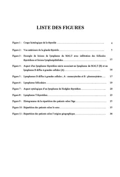 Glande thyroïde : localisation primitive rare du lymphome