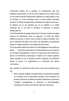 Ventriculographie isotopique