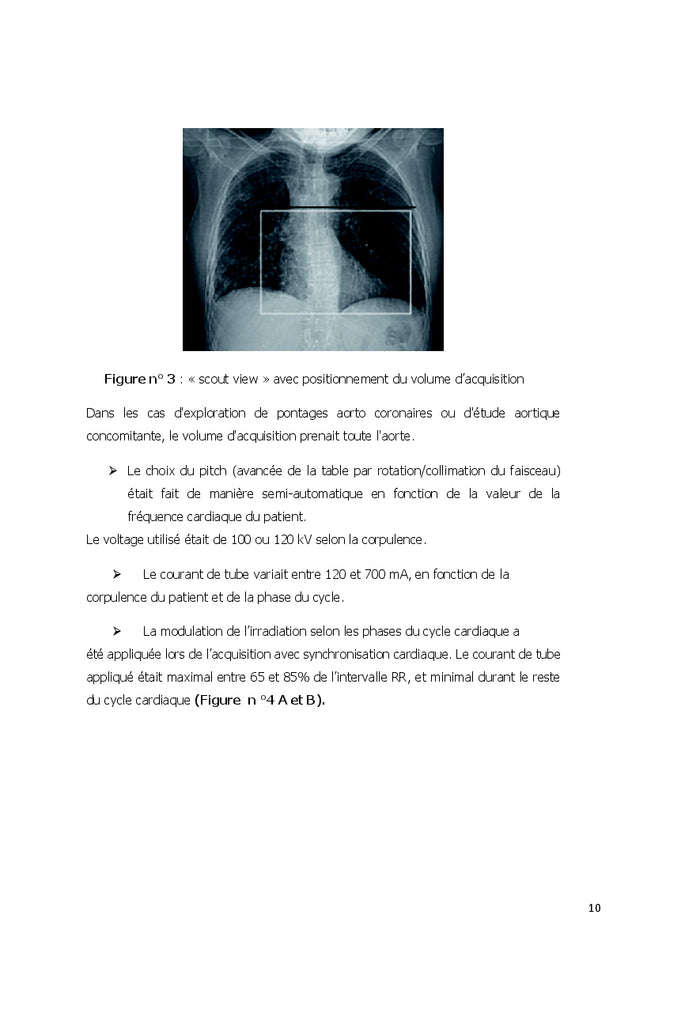 Performances, limites et implications pratiques du coroscanner