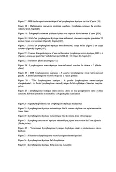 Lymphangiomes kystiques chez l'enfant