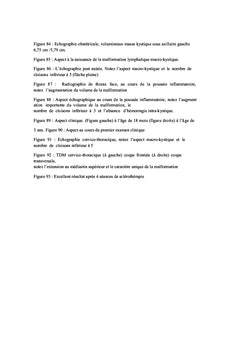 Lymphangiomes kystiques chez l'enfant