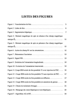 Segmentation des artères et des veines hépatiques