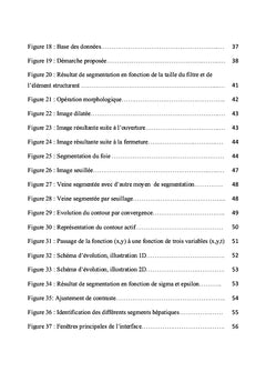 Segmentation des artères et des veines hépatiques