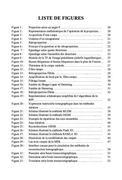 Tomoscintigraphie à l'111In-pentétréotide