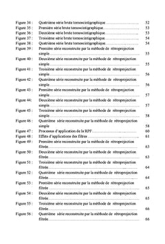 Tomoscintigraphie à l'111In-pentétréotide