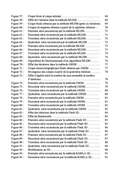 Tomoscintigraphie à l'111In-pentétréotide