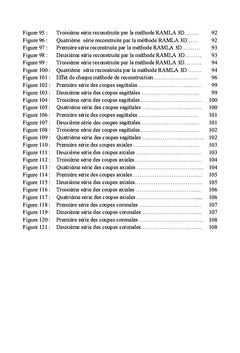 Tomoscintigraphie à l'111In-pentétréotide