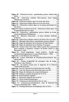 Considérations sur la tuberculose humaine et bovine