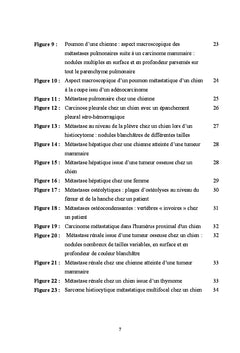Physiopathogenie des metastases