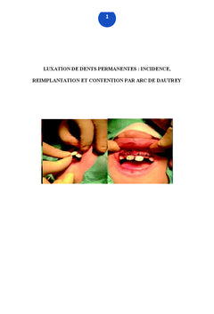 Luxation des dents permanentes