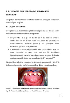 Réhabilitation occluso-prothétique chez l'enfant