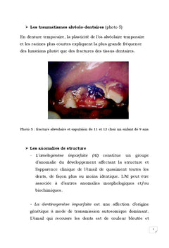 Réhabilitation occluso-prothétique chez l'enfant