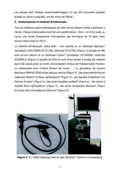 La Chromoendoscopie virtuelle et caractérisation des polypes