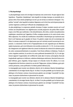 Névralgie faciale
