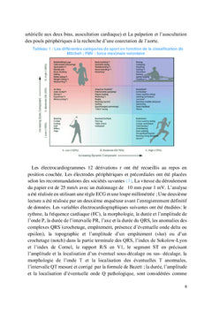 Analyse de l'électrocardiogramme chez les sportifs de compétitions