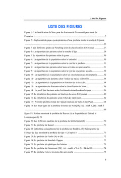Prothèse inversée de l'épaule et fractures complexes