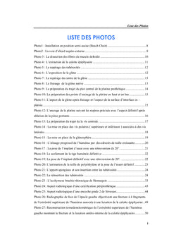 Prothèse inversée de l'épaule et fractures complexes