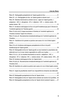 Prothèse inversée de l'épaule et fractures complexes