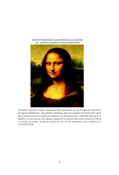 Traitement chirurgical de la paralysie faciale périphérique