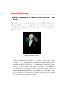 Traitement chirurgical de la paralysie faciale périphérique